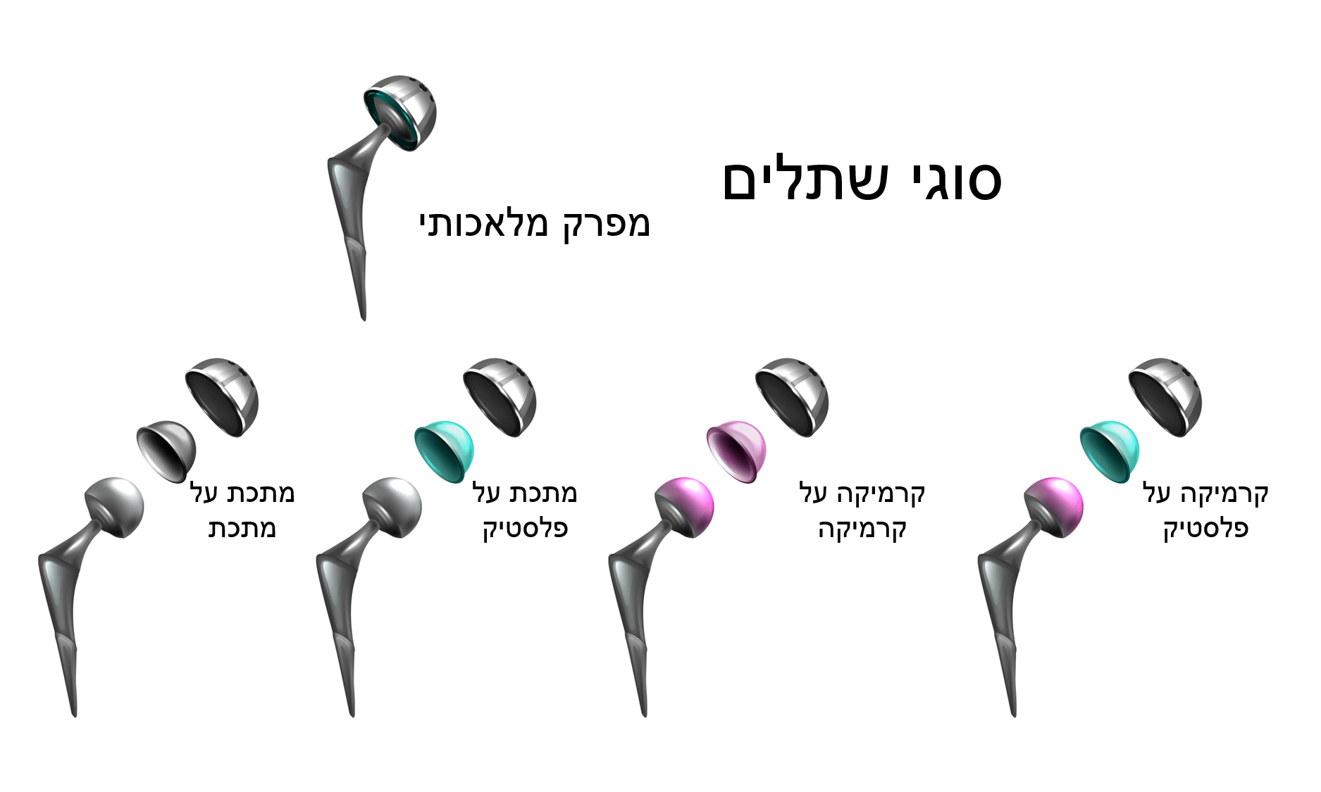 סוגי שתלים לניתוח החלפת ירך - ד