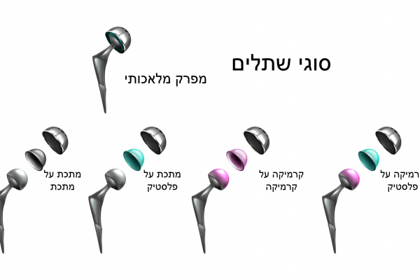 סוגי שתלים לניתוח החלפת ירך