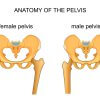 כאבי ירך – ההבדל בין גברים לנשים