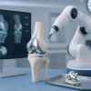 העתיד כבר כאן: כיצד סיוע רובוטי משפר את הדיוק בניתוח החלפת מפרק ברך?